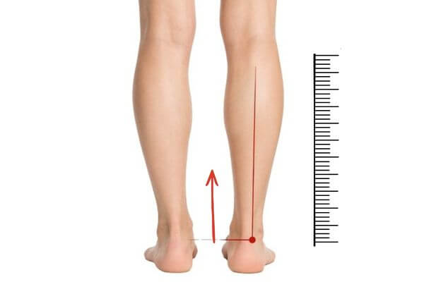 Beinlängendifferenz